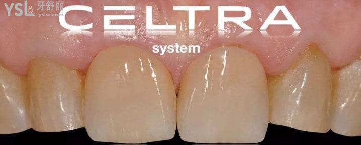 DentsplySirona登士柏西诺德