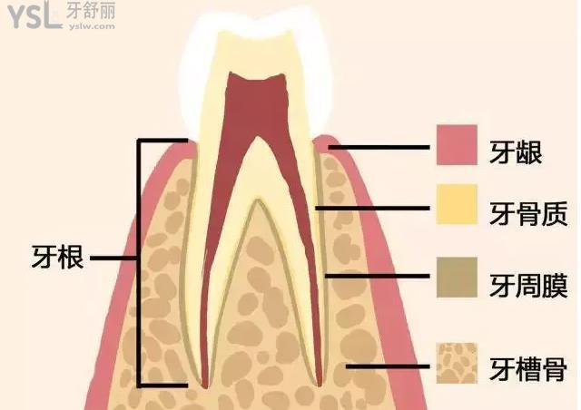 揭秘牙套排齐牙齿的“魔力” 其实原理很简单