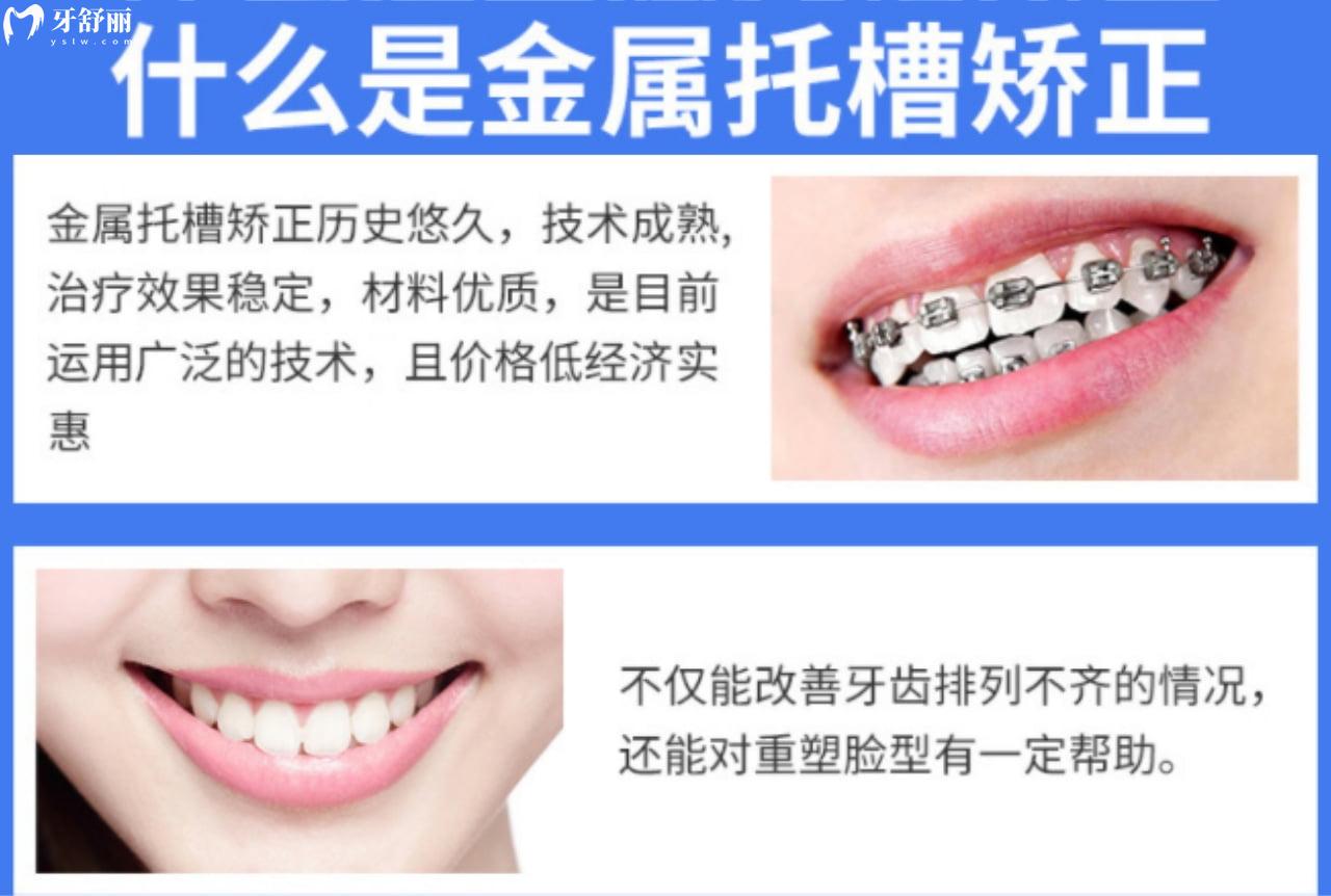 性价比高的金属矫正器