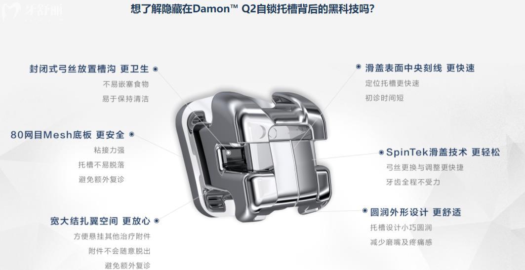 奥美科ormco金属自锁托槽牙套
