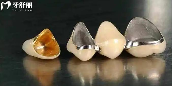 做完根管治疗后选择什么牙冠更好 贵的和便宜的区别大吗