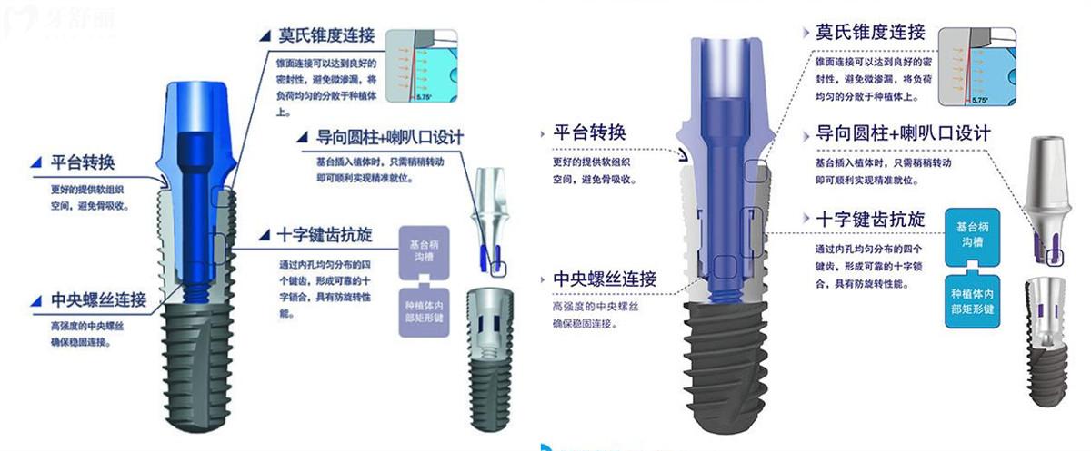 威高种植牙使用寿命有几年 现在多少钱一颗？