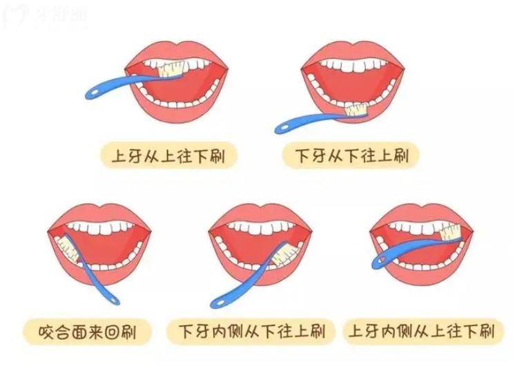 正确刷牙方法图