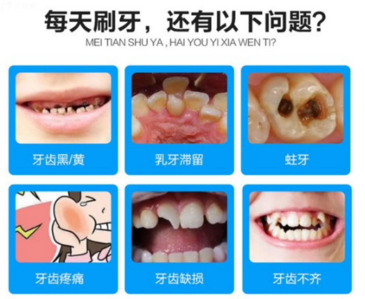 常见牙齿疾病