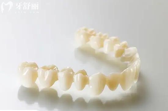 活动假牙和固定假牙以及种植牙的区别和价位对比