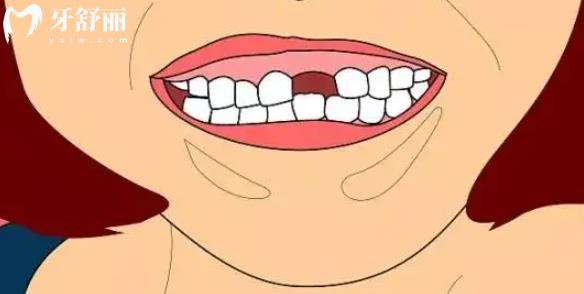 人类牙齿为什么不能再生