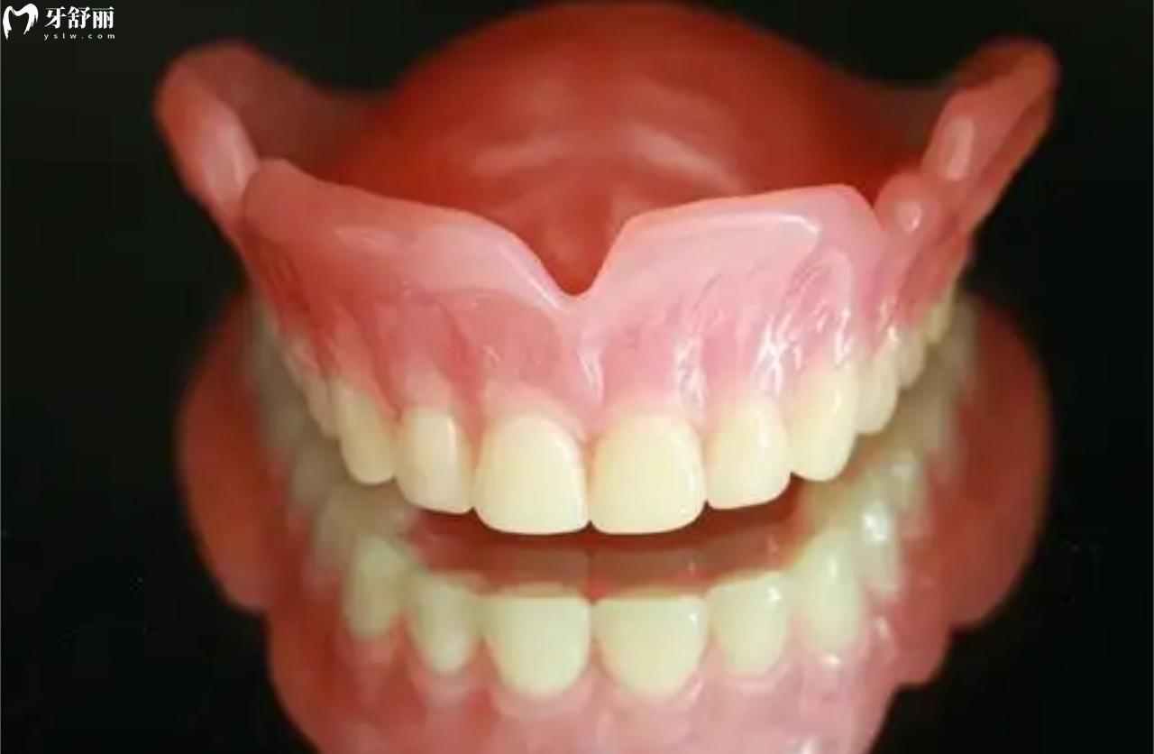 BPS全口吸附性假牙