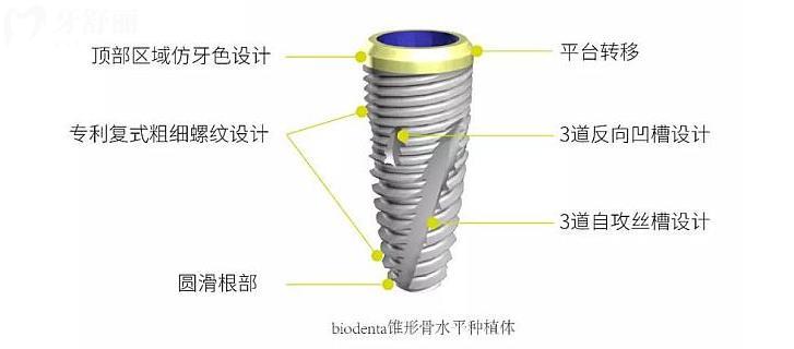 瑞士百丹特种植牙是几级钛 和iti的纯钛是一样的吗？