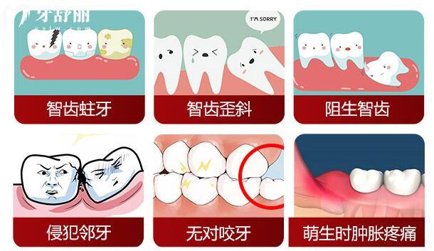 拔完智齿为什么不让带走牙齿?拔智齿需要注意什么事项?.jpg