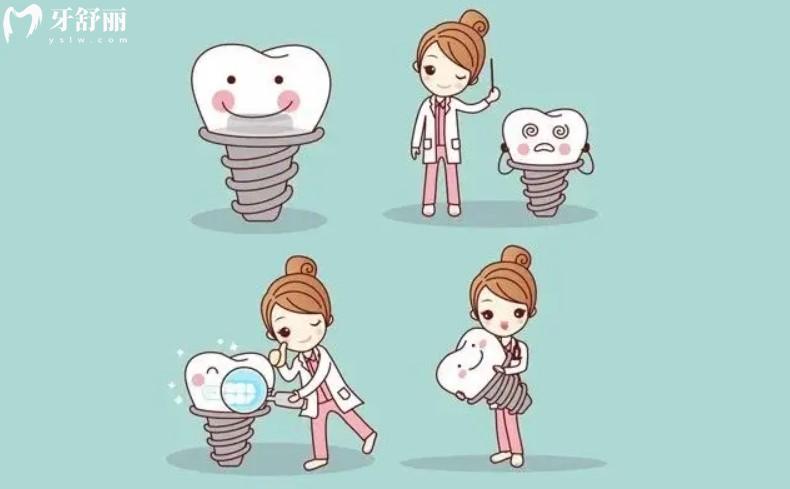 种植牙卡通图