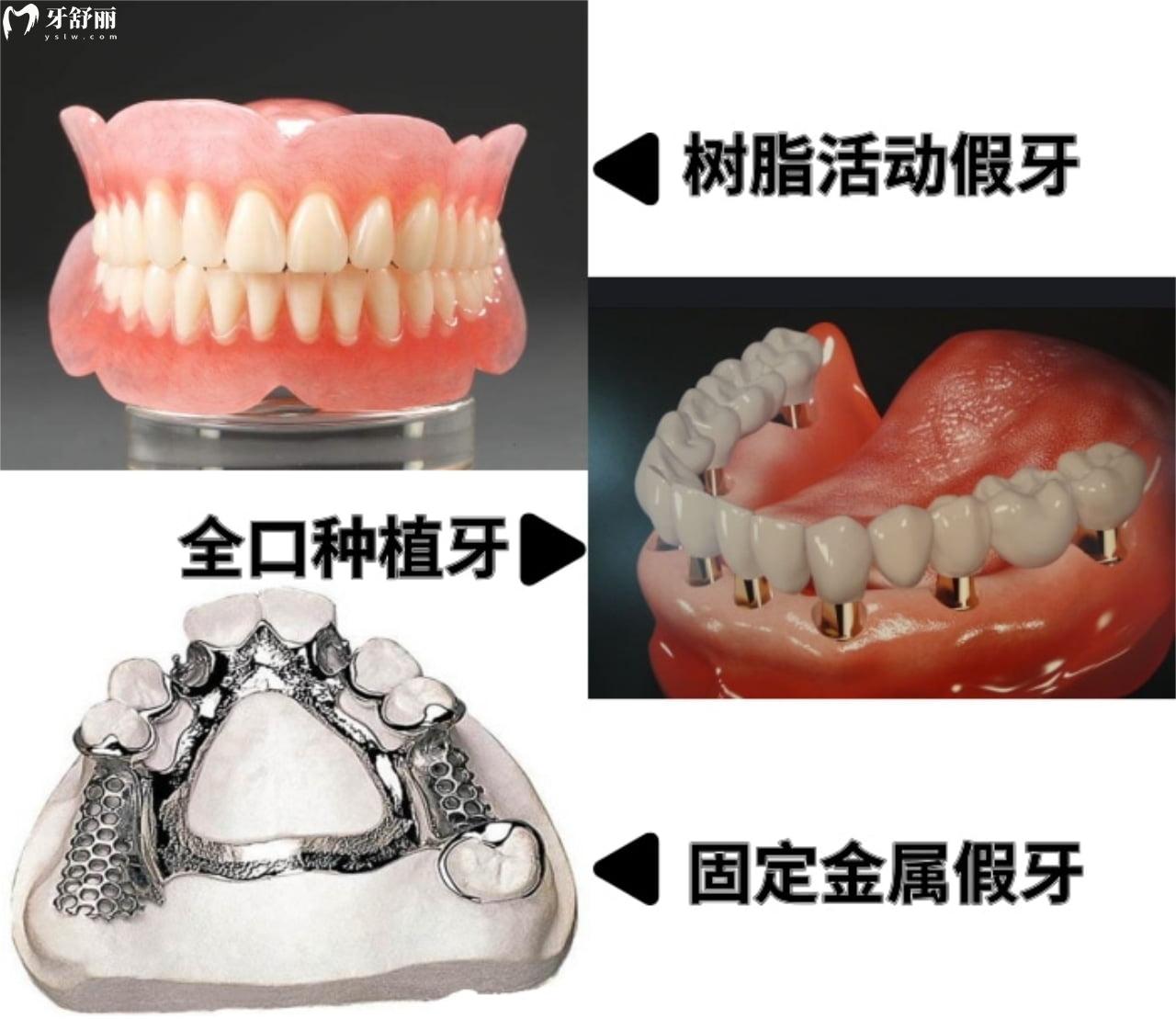 修复缺失牙的三种方法