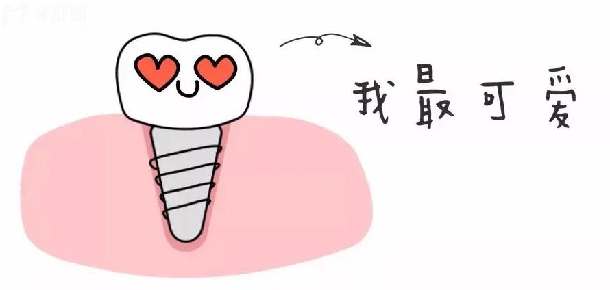 韩国多普勒种植牙使用寿命是多少年