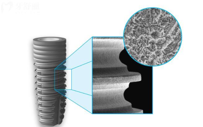 意大利种植牙品牌的有哪些意大利西傲clc种植体是纯钛的吗