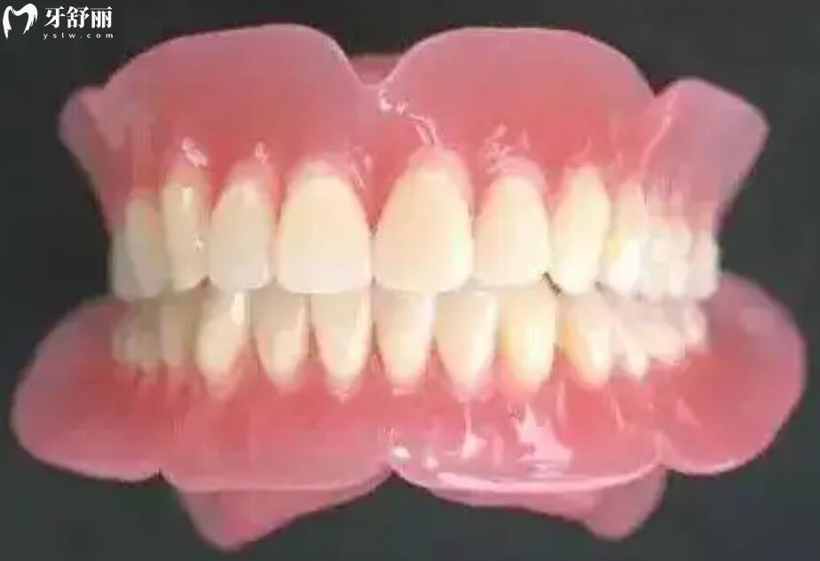 什么是BPS吸附性义齿