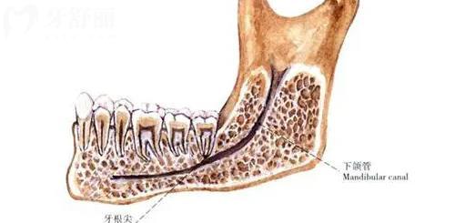 牙医都不告诉你的种植牙危害 盘点种牙五大副作用