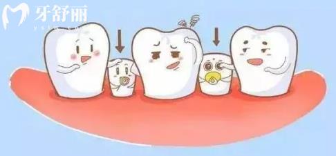 小孩的磨牙已经蛀空了影响换牙吗 心大的家长可要注意了