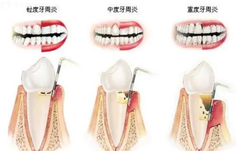 南昌达芬奇口腔活动