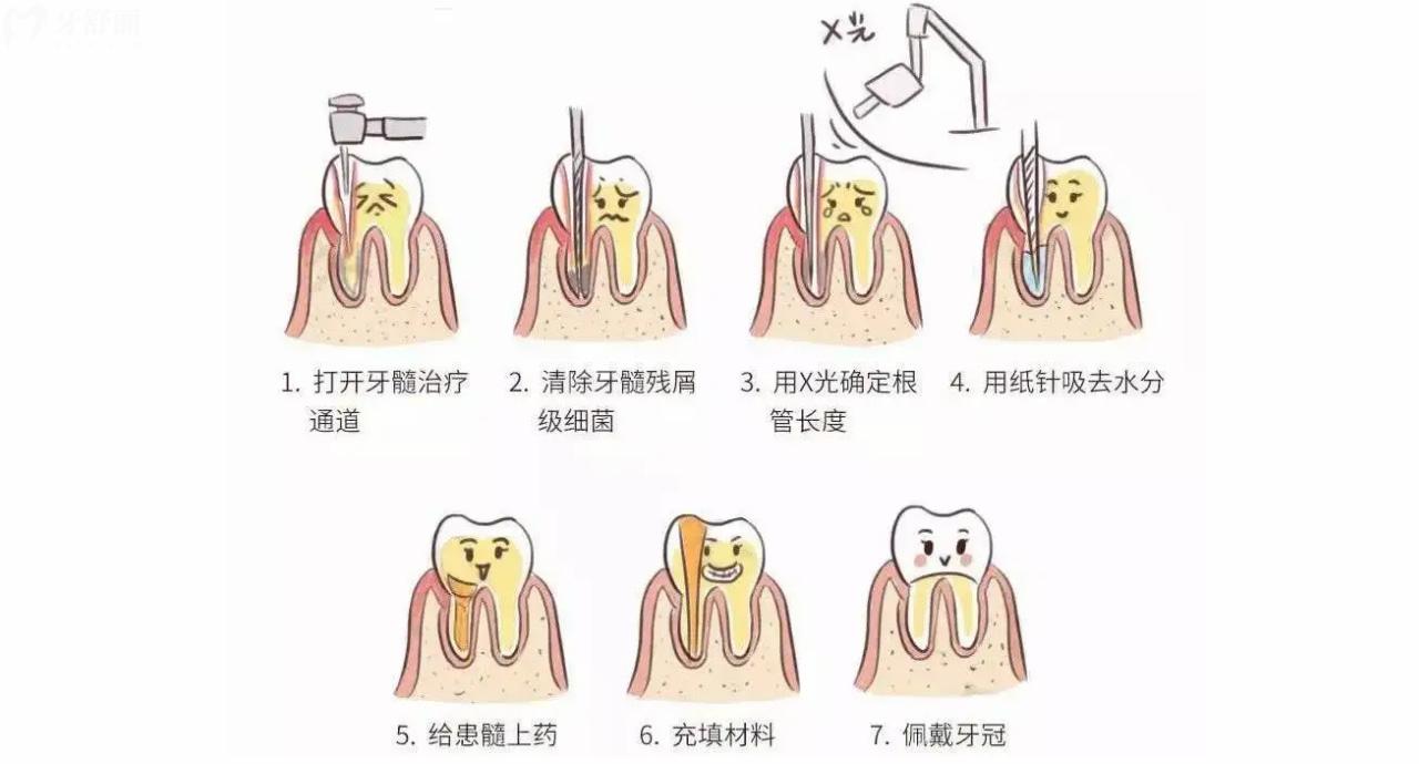 牙髓炎3分钟缓解疼痛办法，区分不同程度的疼痛