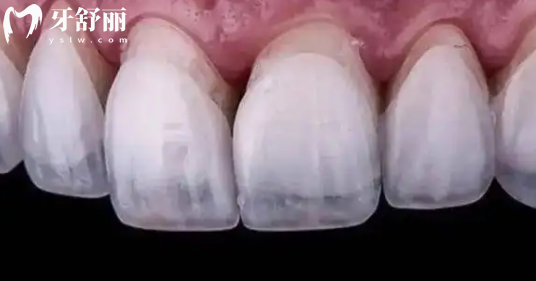 人类牙齿中哪个牙齿的作用更大 是磨牙还是切牙看图片