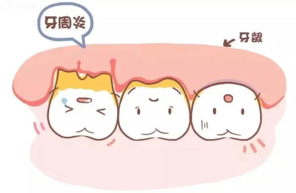 人的牙齿到什么年龄开始松动