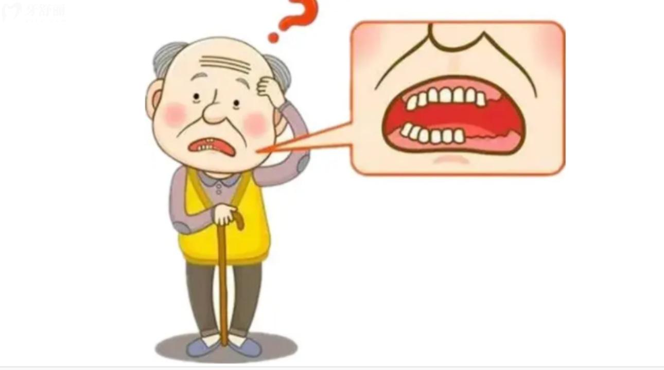 牙齿缺失不及时修复的危害!牙齿缺失修复哪种方法好?