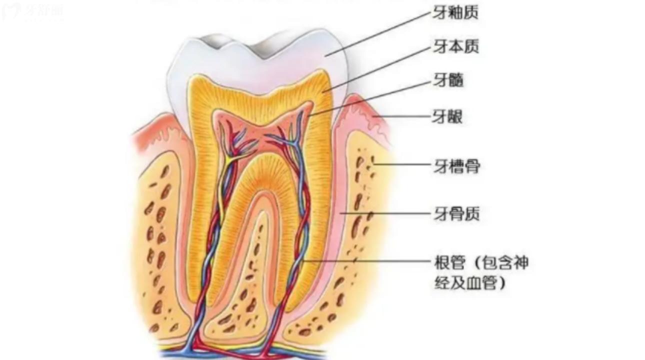 牙神经去除了为什么还痛?去除牙神经后牙能保持多久?