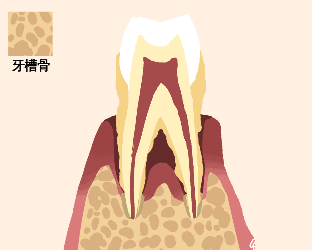 警惕!大牙痛有点松动怎么办?别等种牙了才后悔
