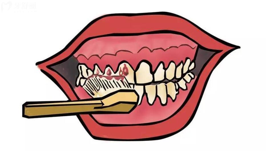 牙龈出血是什么原因导致的
