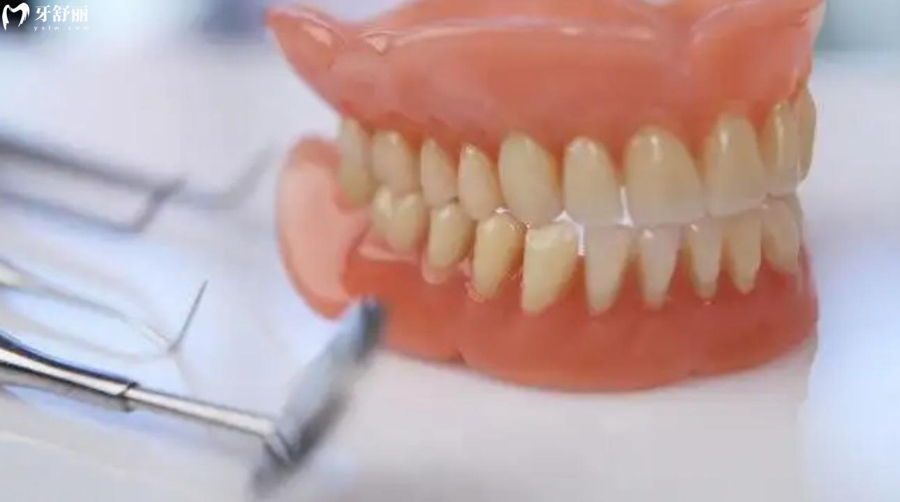 胶托义齿和隐形义齿的优缺点有哪些?活动义齿的种类码住