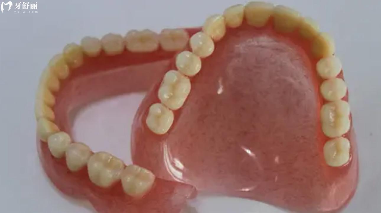 胶托义齿和隐形义齿的优缺点有哪些?活动义齿的种类码住