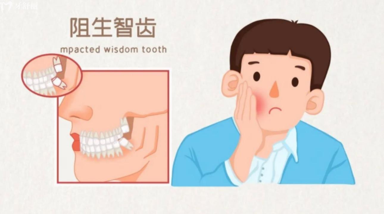 十种智齿不能拔的原因有哪些?哪些智齿可以拔除?