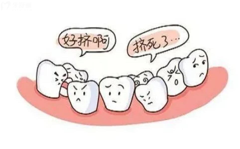 矫正牙齿拔掉的牙什么时候能把空缺填上去?需要注意什么