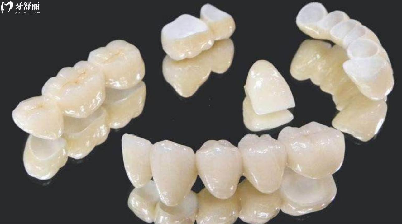 国产爱尔创全瓷牙价格多少钱一颗?全瓷牙800元是真的吗? 国产爱尔创全瓷牙价格多少钱一颗?全瓷牙800元是真的吗?
