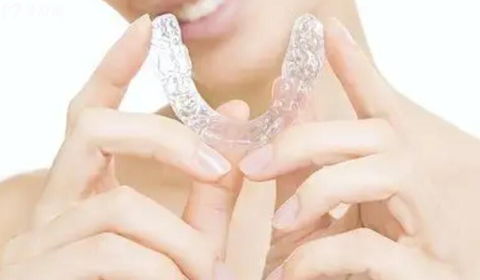 国产隐形矫正牙套品牌有哪些 国产隐形矫正牙套品牌有哪些