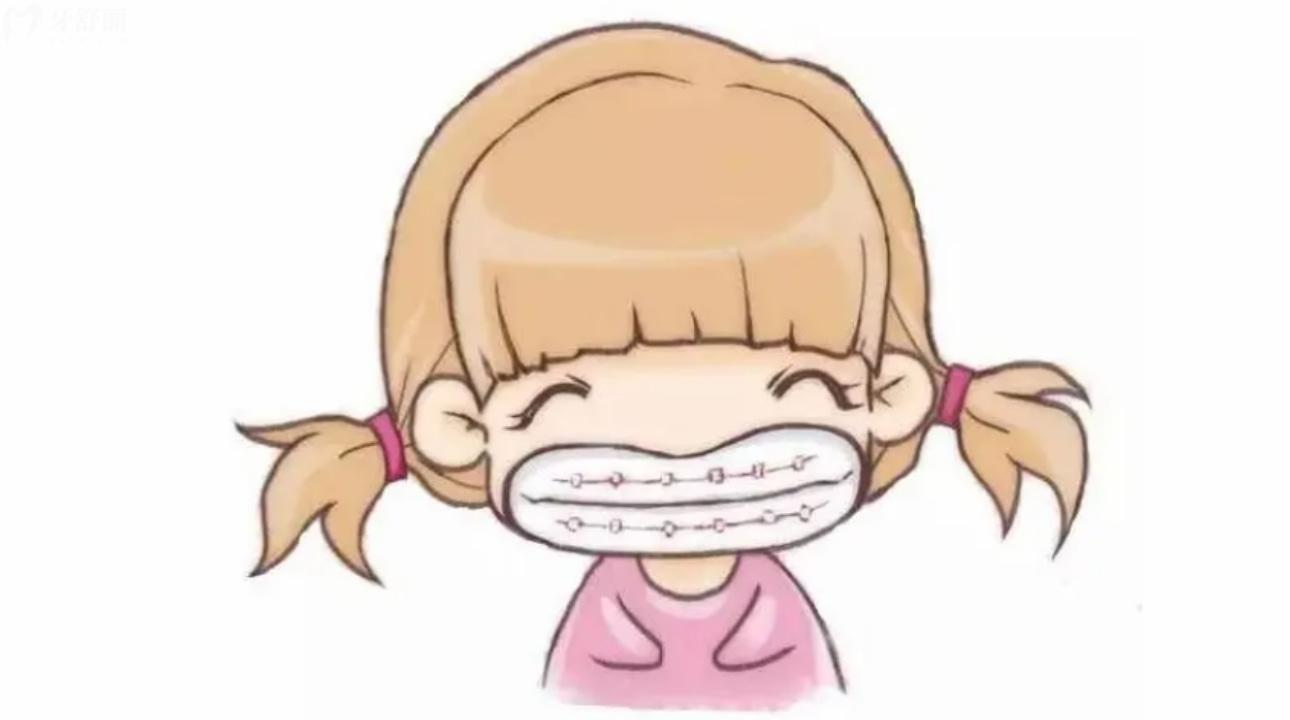 钢牙套价格一般需要多少钱?含隐形/儿童/烤瓷牙套价格表 钢牙套价格一般需要多少钱?含隐形/儿童/烤瓷牙套价格表