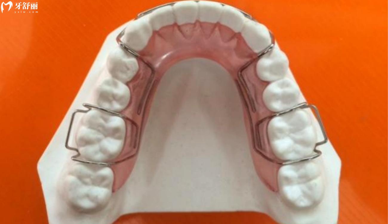 为什么整牙几年后全部反弹了.jpg 为什么整牙几年后全部反弹了.jpg