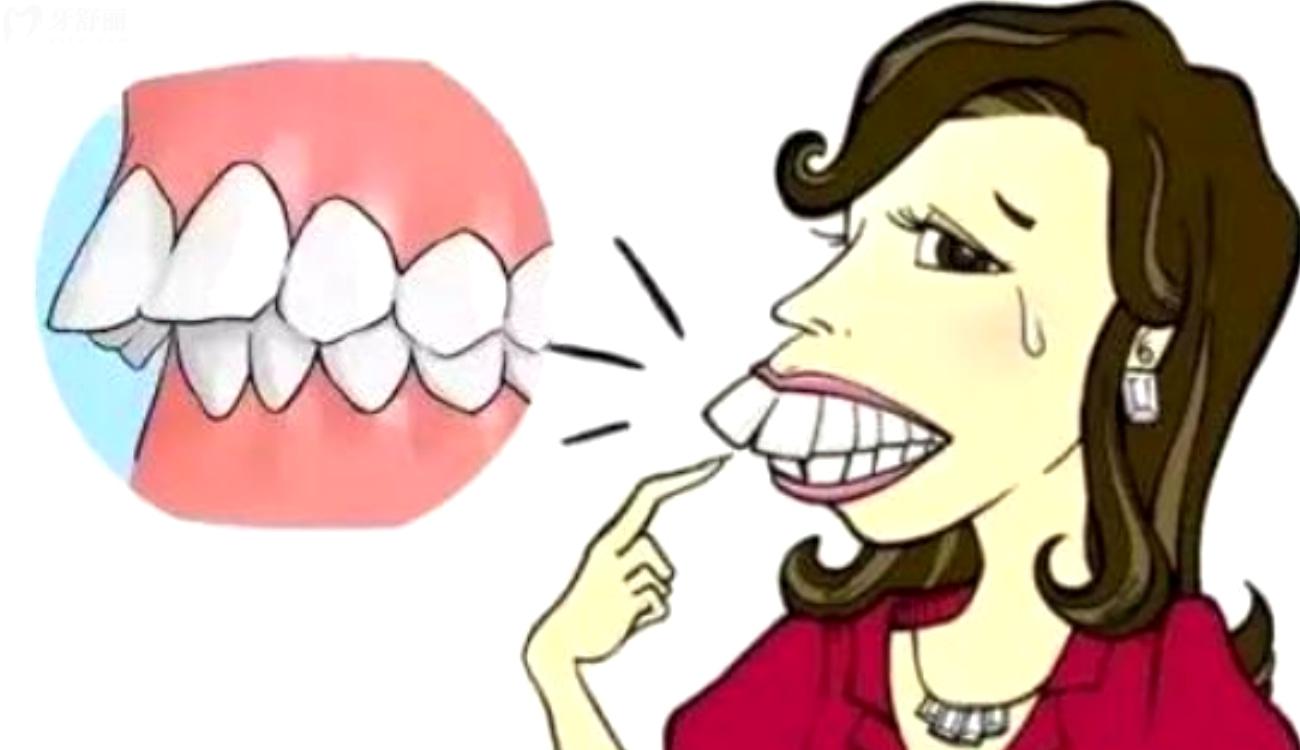 为什么整牙几年后全部反弹了.jpg 为什么整牙几年后全部反弹了.jpg