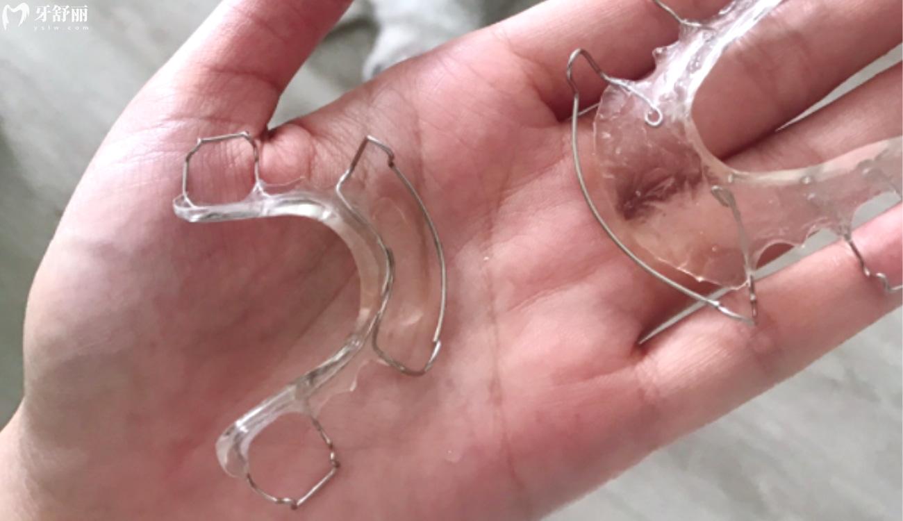 保持器一 天不戴就紧紧的是什么原因.jpg 保持器一 天不戴就紧紧的是什么原因.jpg