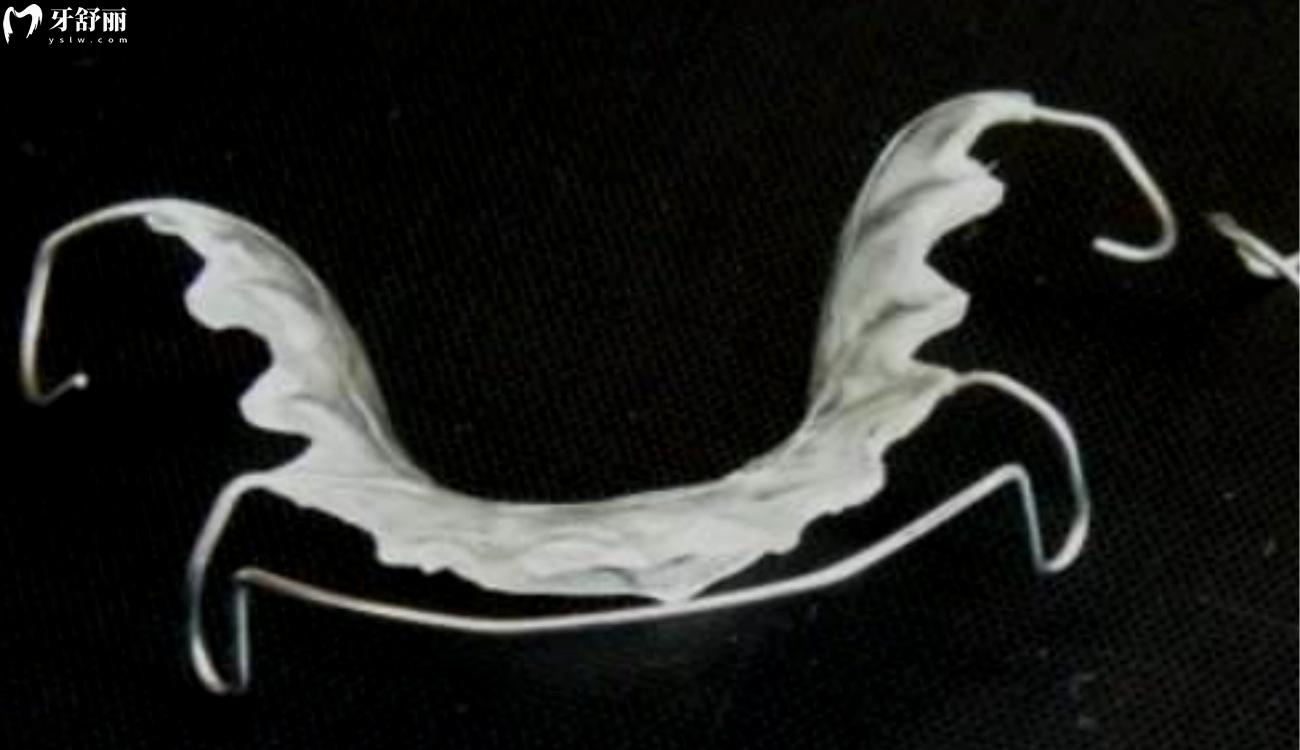 保持器一 天不戴就紧紧的是什么原因.jpg 保持器一 天不戴就紧紧的是什么原因.jpg