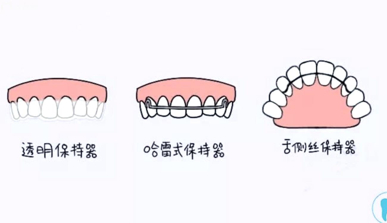 正畸后反弹的几率有多大.jpg 正畸后反弹的几率有多大.jpg