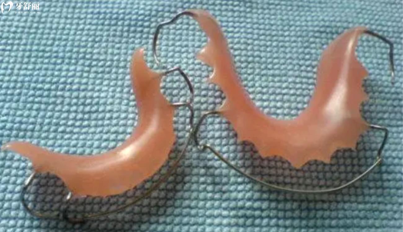 正畸后反弹的几率有多大.jpg 正畸后反弹的几率有多大.jpg