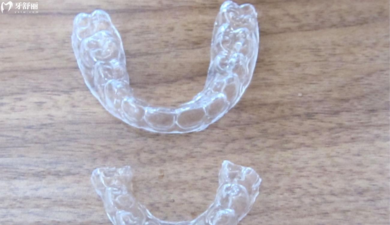 正畸后反弹的几率有多大.jpg 正畸后反弹的几率有多大.jpg