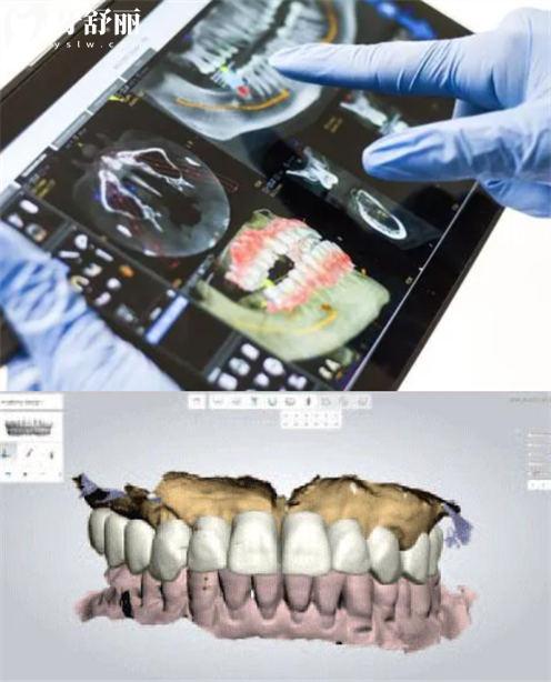 新型种植技术是不是智商税?盘点有哪些靠谱种植牙手术 新型种植技术是不是智商税?盘点有哪些靠谱种植牙手术