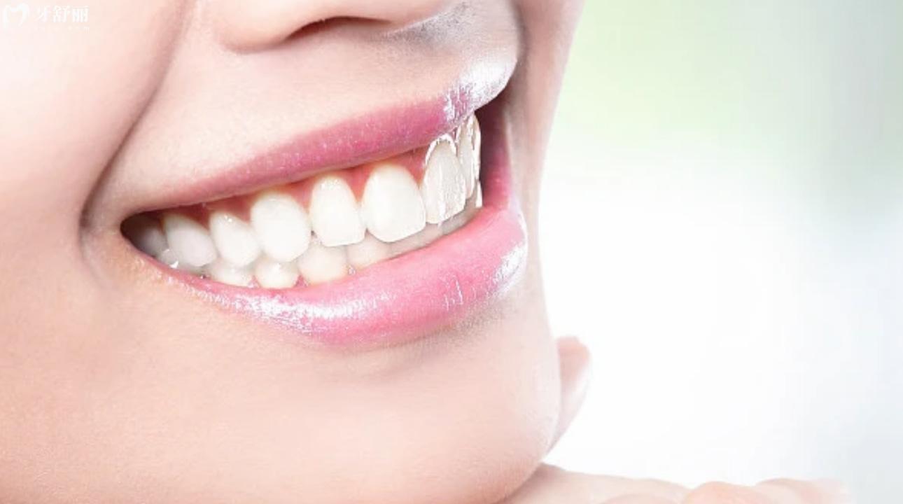 冲牙器会不会把牙缝越洗越大?冲牙器可以代替刷牙吗? 冲牙器会不会把牙缝越洗越大?冲牙器可以代替刷牙吗?