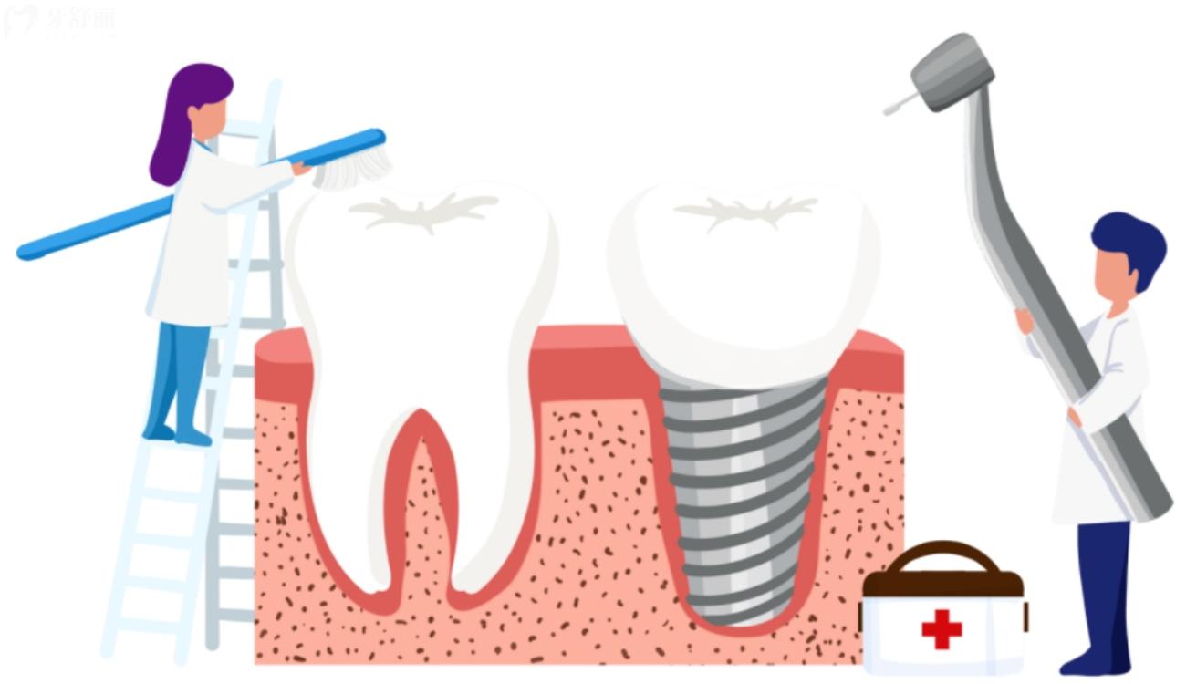种植牙齿什么品牌比较好.jpg 种植牙齿什么品牌比较好.jpg