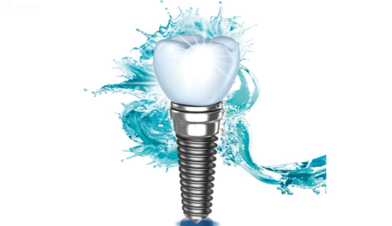 种植牙齿什么品牌比较好.jpg 种植牙齿什么品牌比较好.jpg