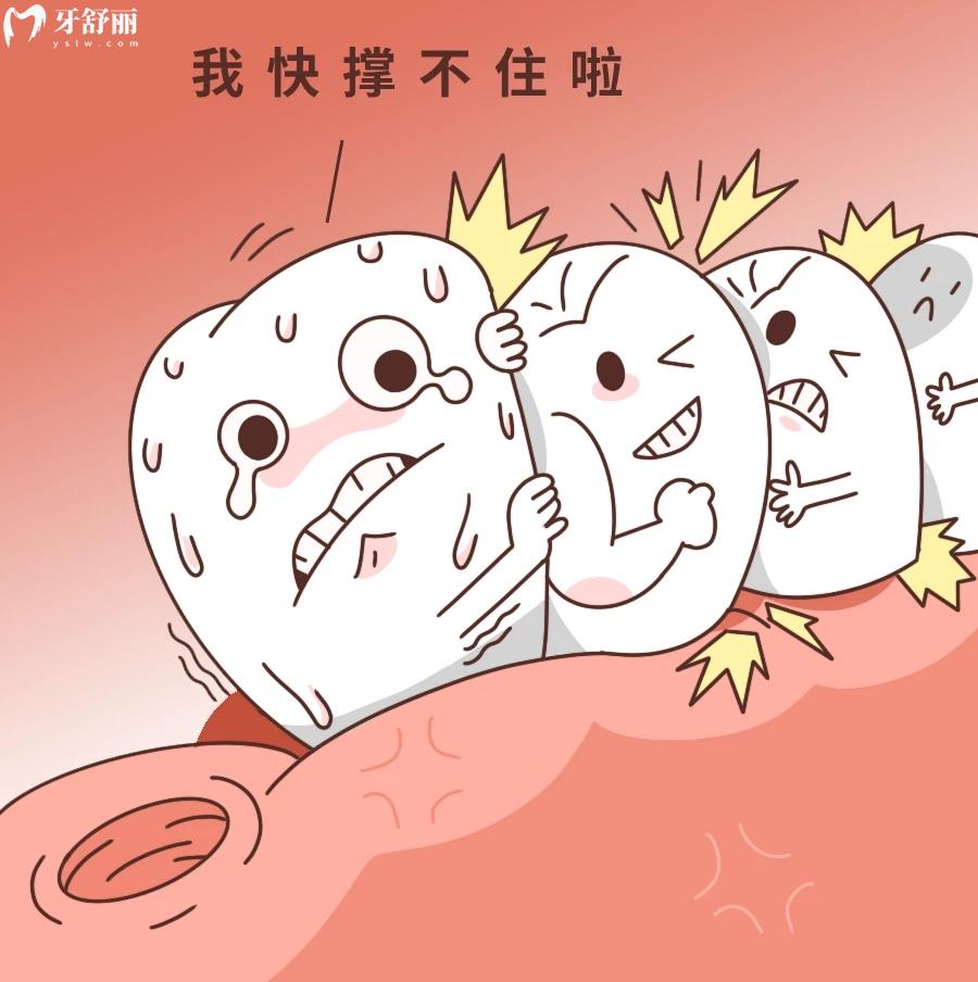 不注意护理,将近2W的种植牙失败了后悔一辈子 不注意护理,将近2W的种植牙失败了后悔一辈子