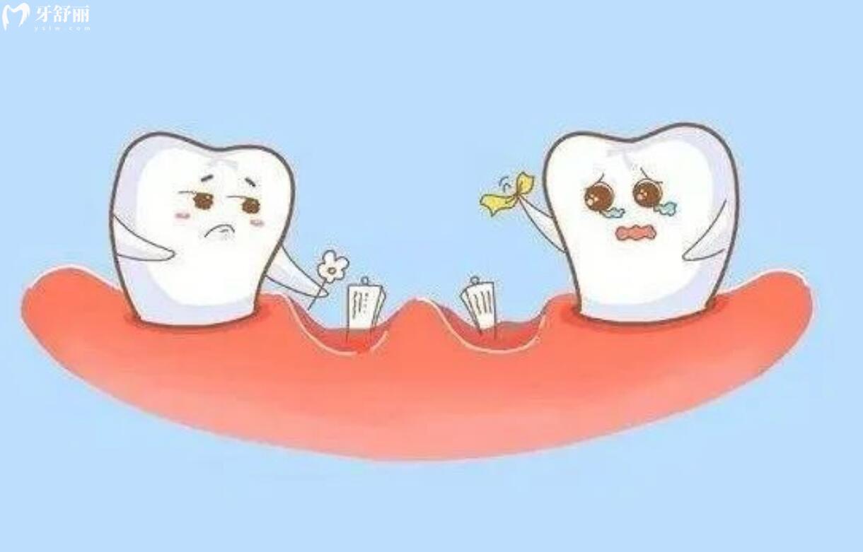 老年人一般从什么时候开始掉牙正常？掉牙后应该注意什么？