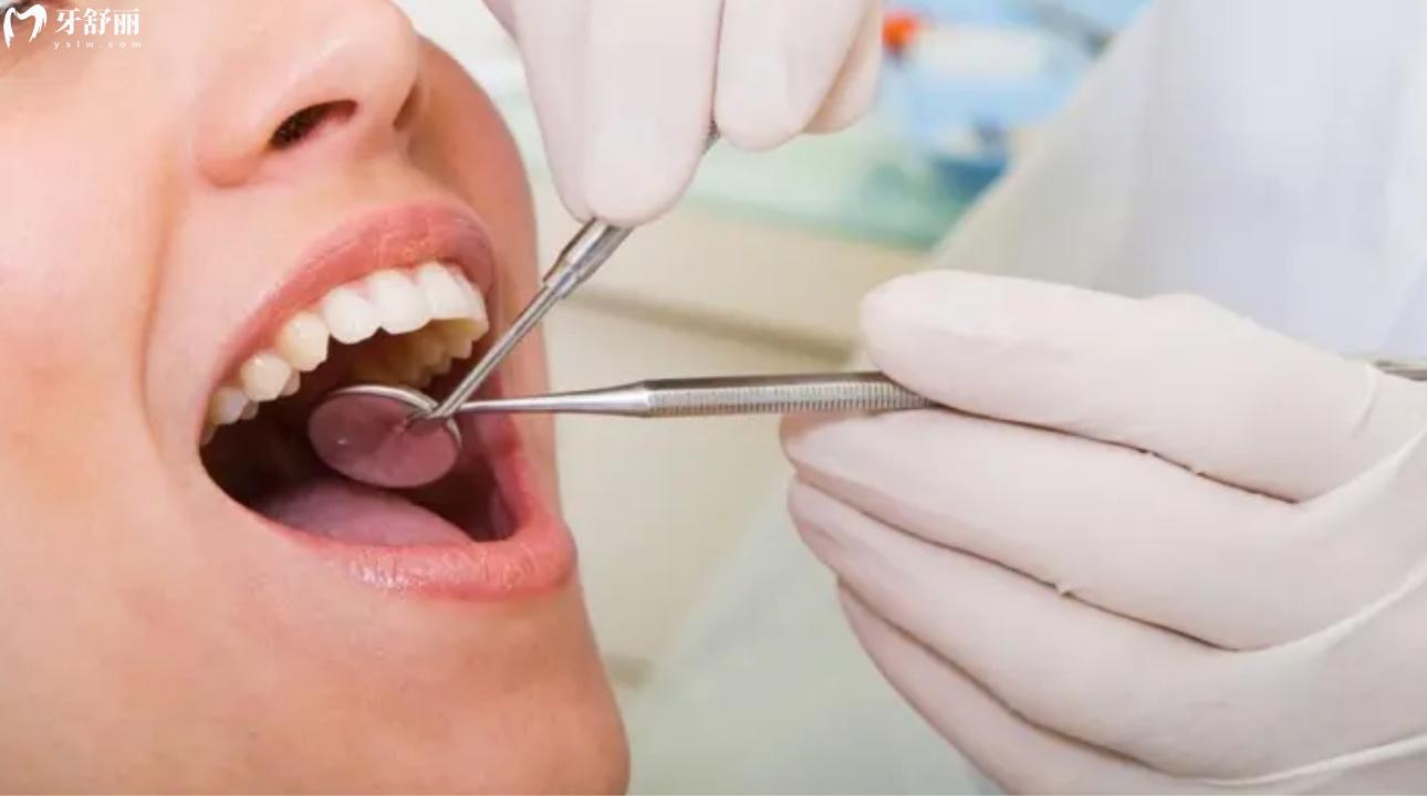 科尔树脂补牙能用多久?来看看它怎么样?型号有哪些? 科尔树脂补牙能用多久?来看看它怎么样?型号有哪些?