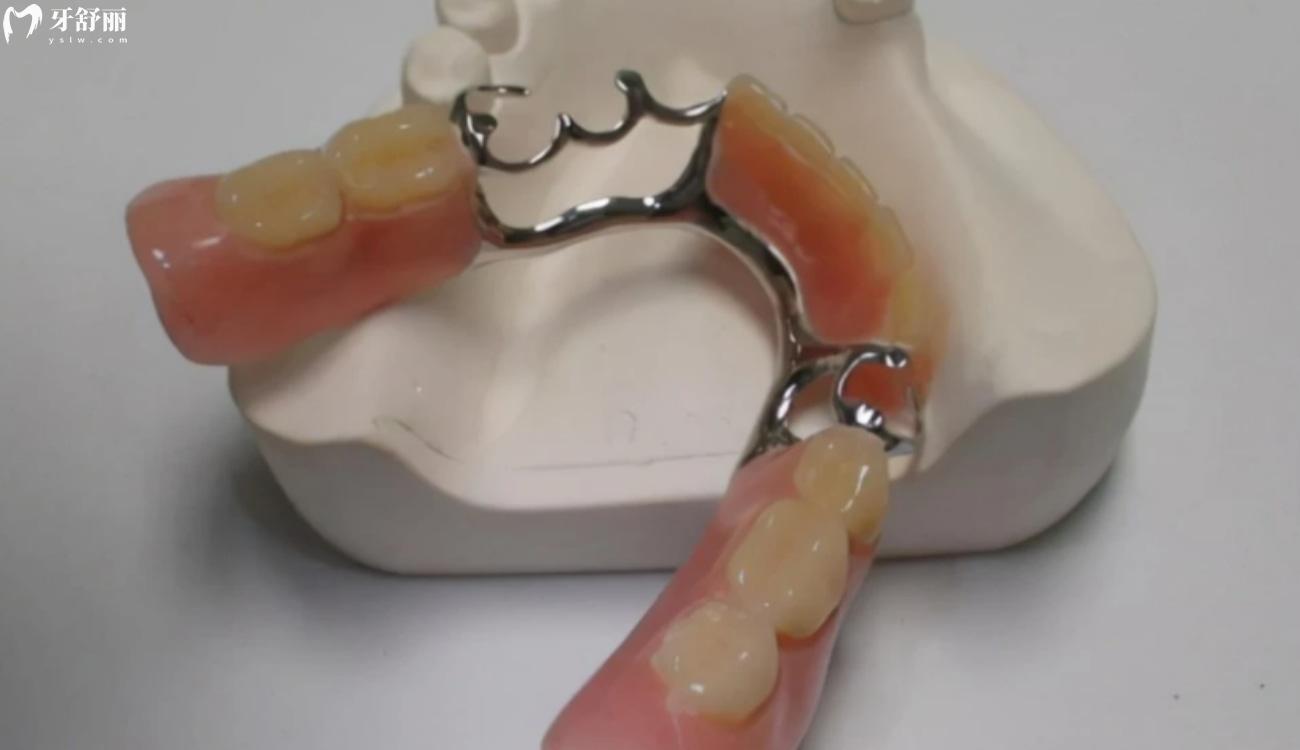 全口假牙价目表.jpg 全口假牙价目表.jpg